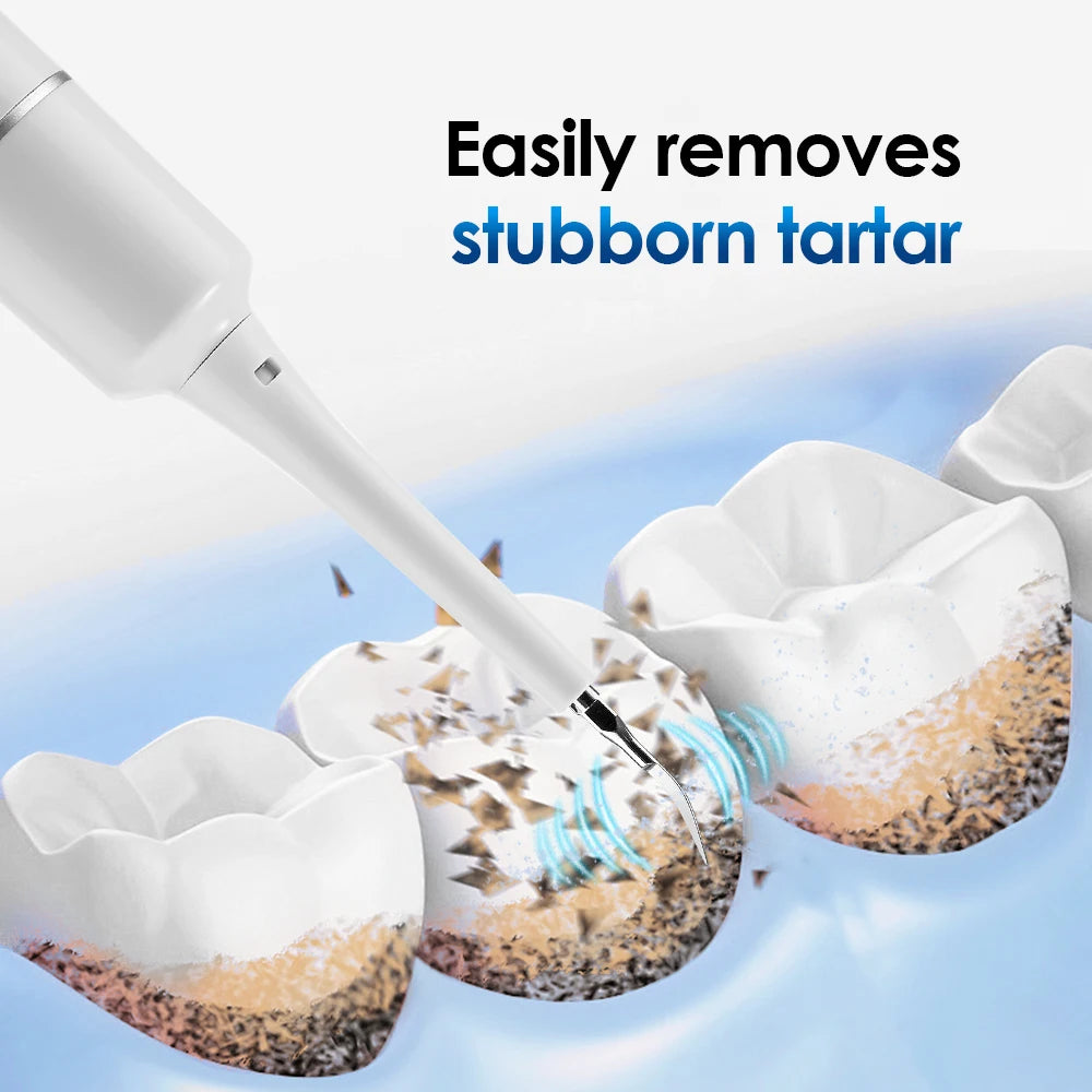 SonicPolish Tooth Cleaner | Rechargeable Plaque Remover