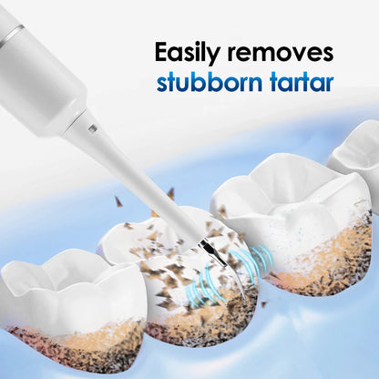 SonicPolish Tooth Cleaner | Rechargeable Plaque Remover