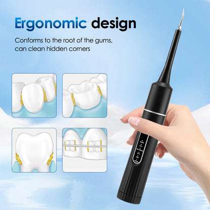 SonicPolish Tooth Cleaner | Rechargeable Plaque Remover